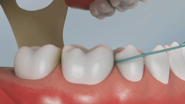 uso de fio dental em dentes inferiores