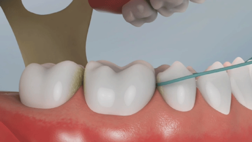 Veja como utilizar o fio dental nos dentes inferiores da boca