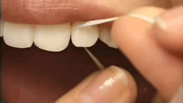 Demonstração do fio dental limpando as laterais os dentes de uma pessoa