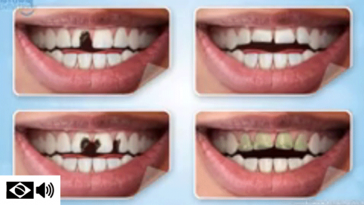 Quatro problemas odontolólgicos que podem ser resolvidos por meio de um tratamento dentário estético